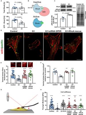 G Protein-Coupled Estrogen Receptor Regulates Actin Cytoskeleton Dynamics to Impair Cell Polarization